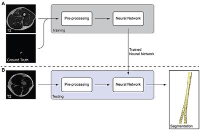 Segmentation of Peripheral Nerves From Magnetic Resonance Neurography: A Fully-Automatic, Deep Learning-Based Approach